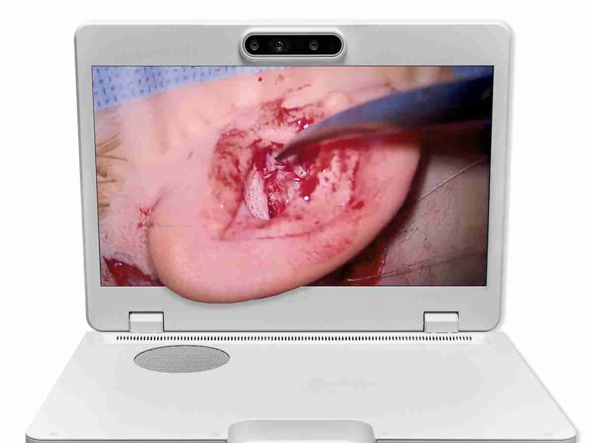 达擎之＂Heads-up 3D显微手术显示系统＂，，，整合4K裸眼3D显示及眼球追踪系统，，，具备快速追踪人眼移动位置功能，，，，减轻医师长时间维持固定姿势的负担，，，，让医师能有更宽广清晰的3D立体视野及更舒适的姿势来执行手术。。。